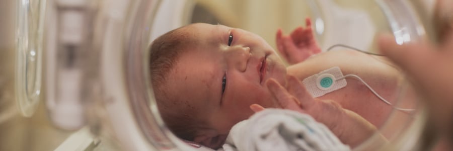 newborn in the NICU.