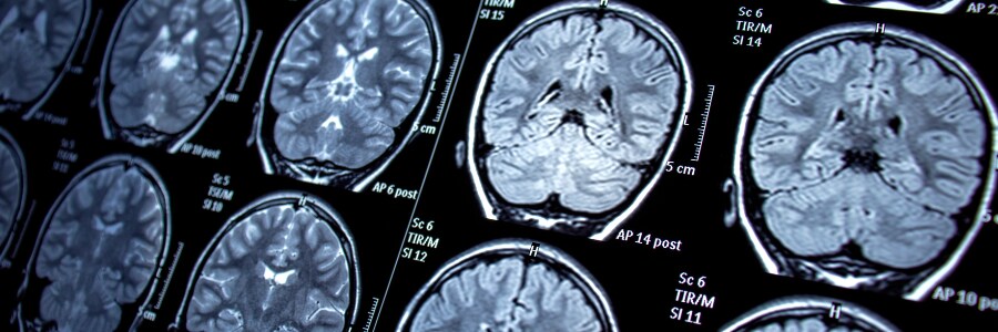 Neurosciences & Neurosurgery